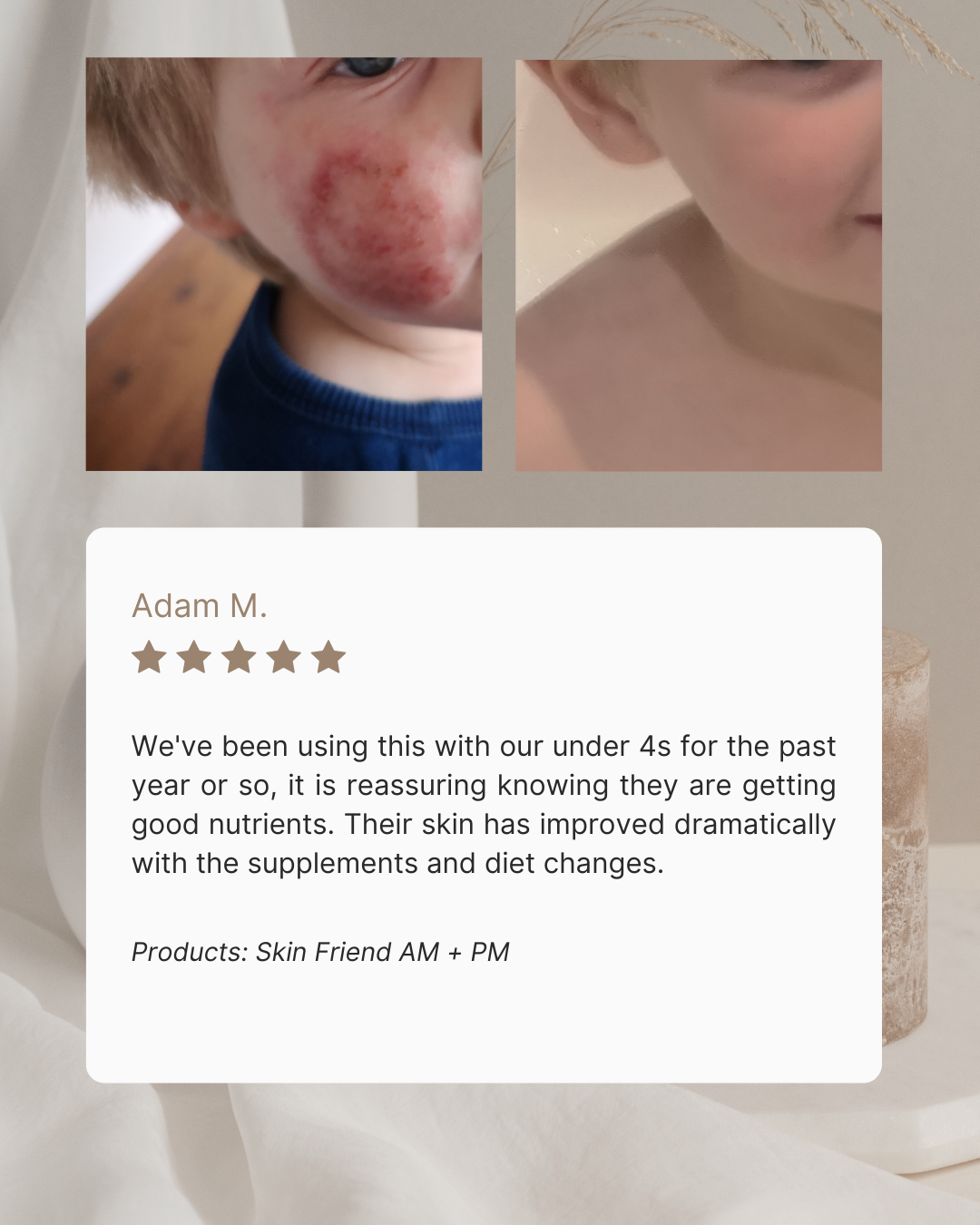 Skin Friend AM | Skin & Gut
