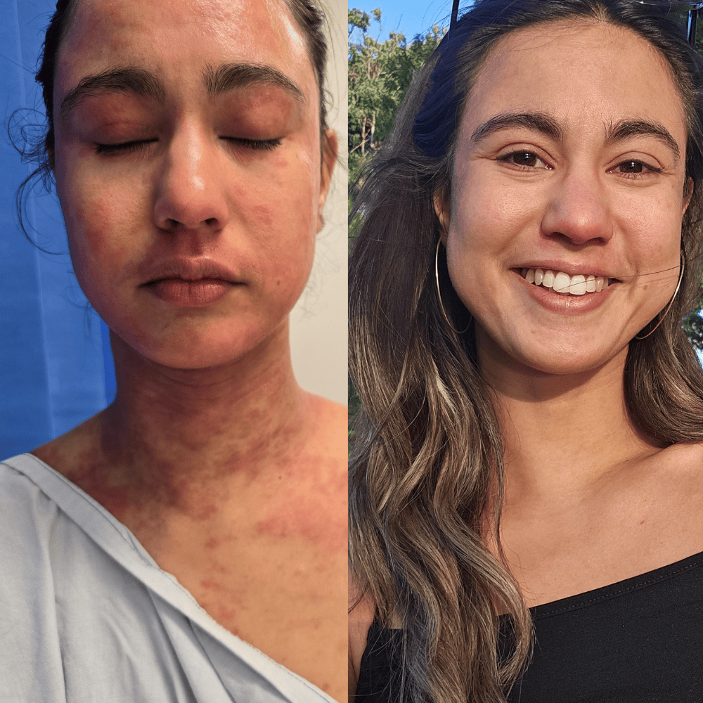 Skin Microbiome: The Missing Link in Most Skincare Routines (Part 1)