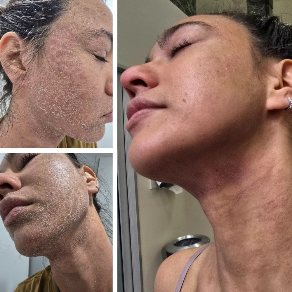 Raine’s Recovery: Infection + Immune Support Plan (Part 2)