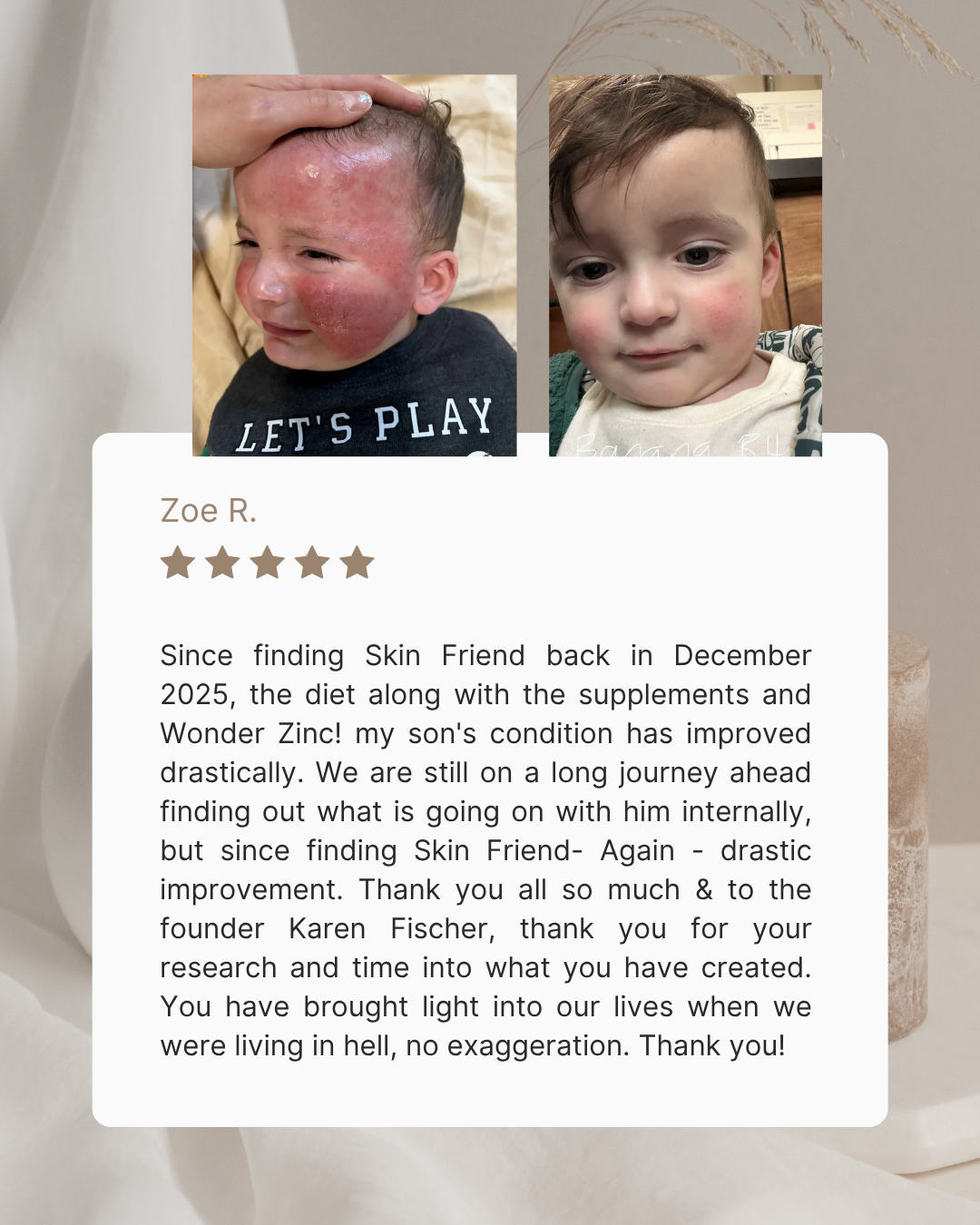 Wonder Zinc | Skin Barrier Cream