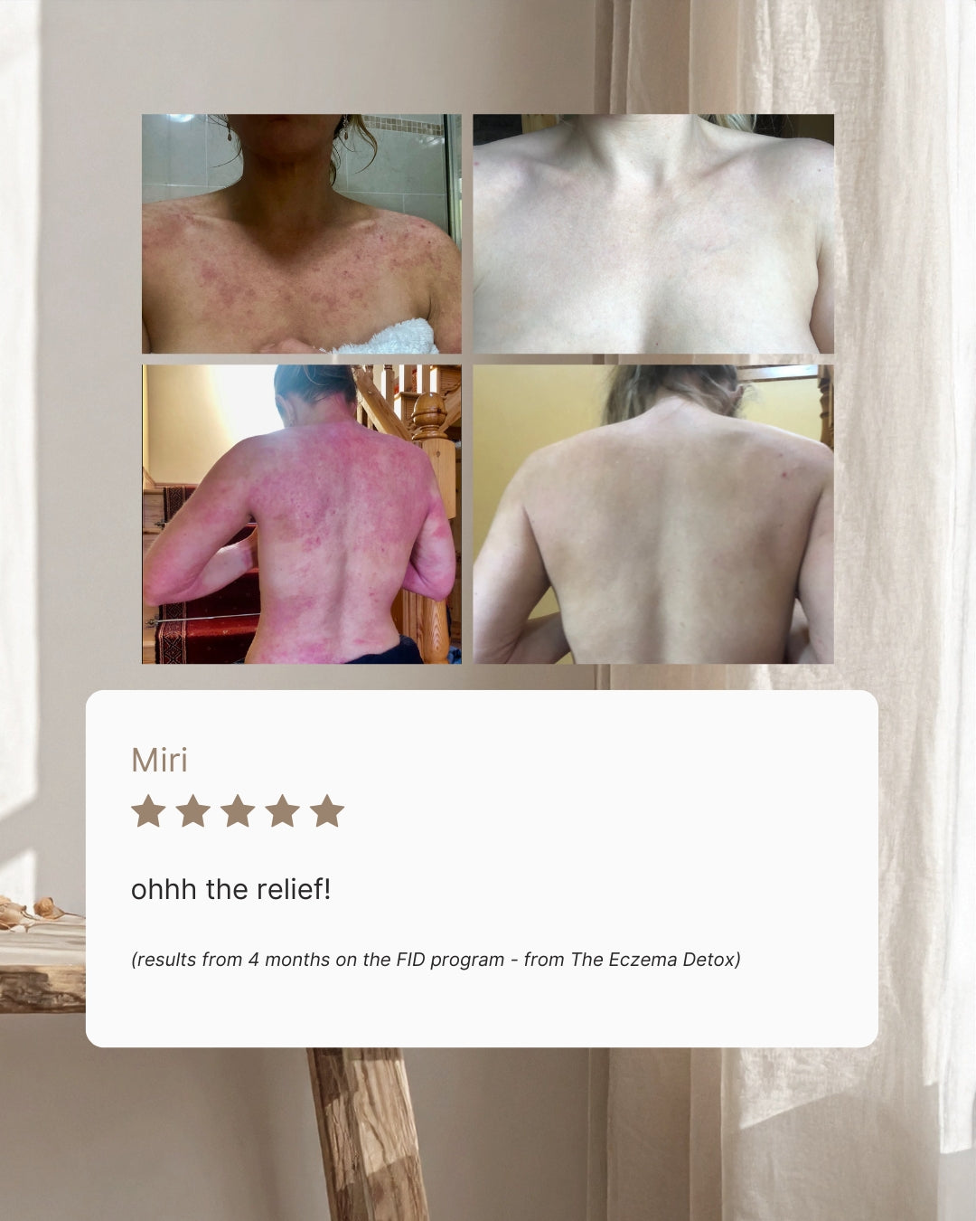 The Eczema Detox  | Skin + Gut Bundle