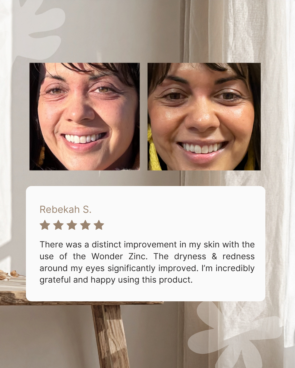 Wonder Zinc | Skin Barrier Cream