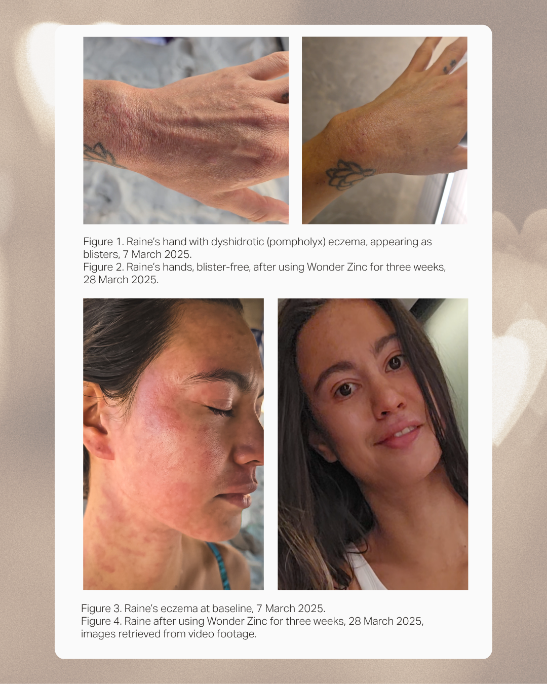 Wonder Zinc | Skin Barrier Cream